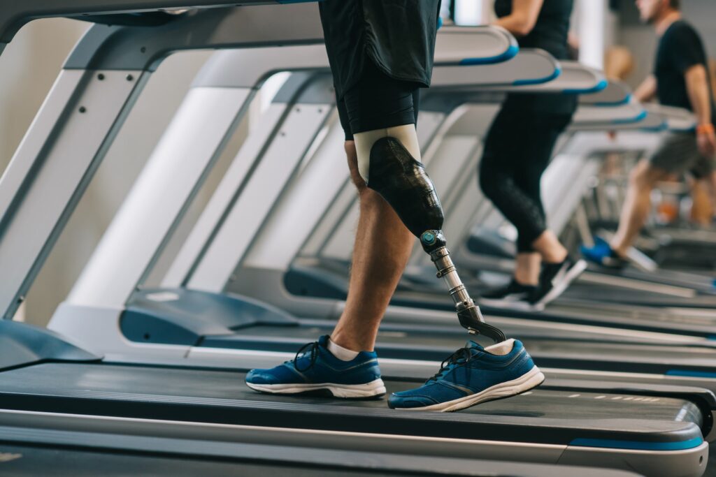 man on treadmill with prosthetic leg